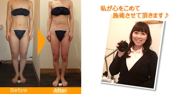 セルライト除去のビフォーアフター