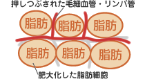 代謝が悪くなる