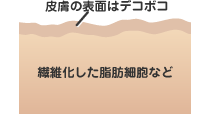 皮膚の表面はデコボコ
